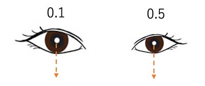 雌雄眼の左右の眼の視力の差